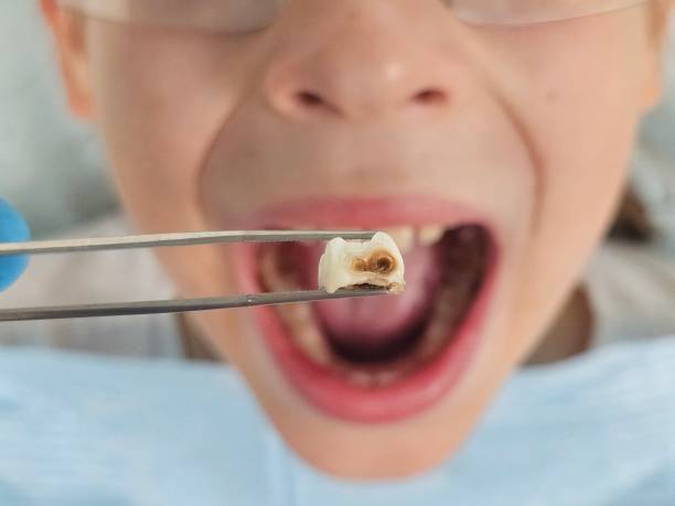 Best Emergency Tooth Extraction in Gosnell, AR
